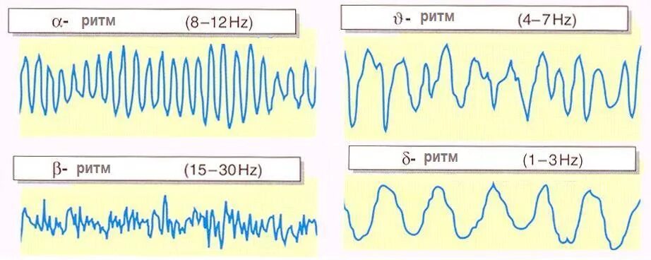 Частота ээг. Амплитуда Альфа-ритма ЭЭГ. Амплитуда ритмов ЭЭГ. Альфа волны ЭЭГ. Сигма ритм на ЭЭГ.