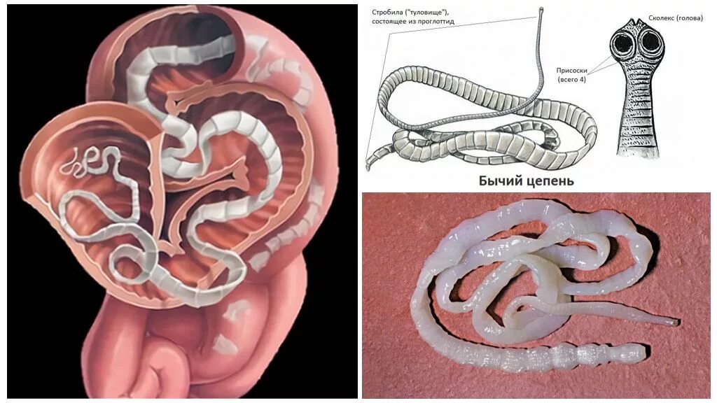 Ленточные черви свиной бычий цепни. Черви паразиты бычий цепень. Ленточный червь бычий цепень.