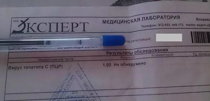 Пцр крови на гепатит. ПЦР анализ на гепатит с. Расшифровка анализа на гепатит с ПЦР. ПЦР количественный гепатит с. Анализ на ПЦР на вирус гепатита в.