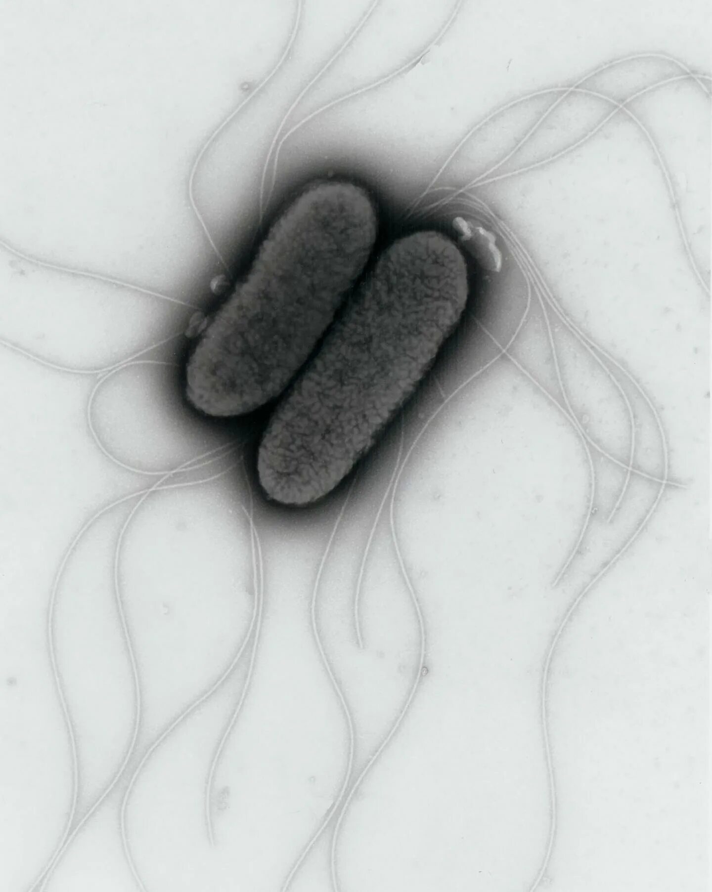 Бактерия сальмонелла Тифи. Сальмонелла тифимуриум. Сальмонелла — бацилла. Сальмонеллез бактерия
