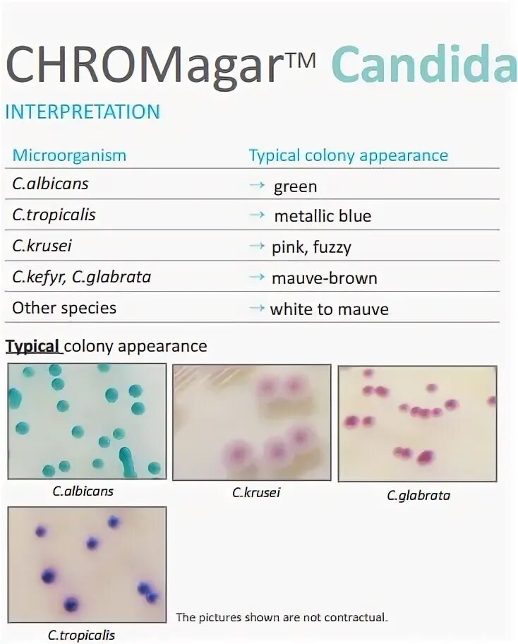 Candida albicans лечение. Кандида альбиканс мазок. Candida albicans анализ нормы. ПЦР кандида альбиканс.