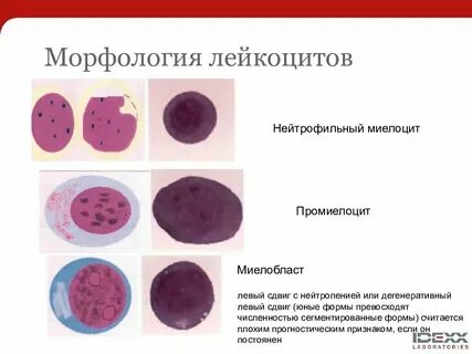 Лейкоциты полуколичественно что это
