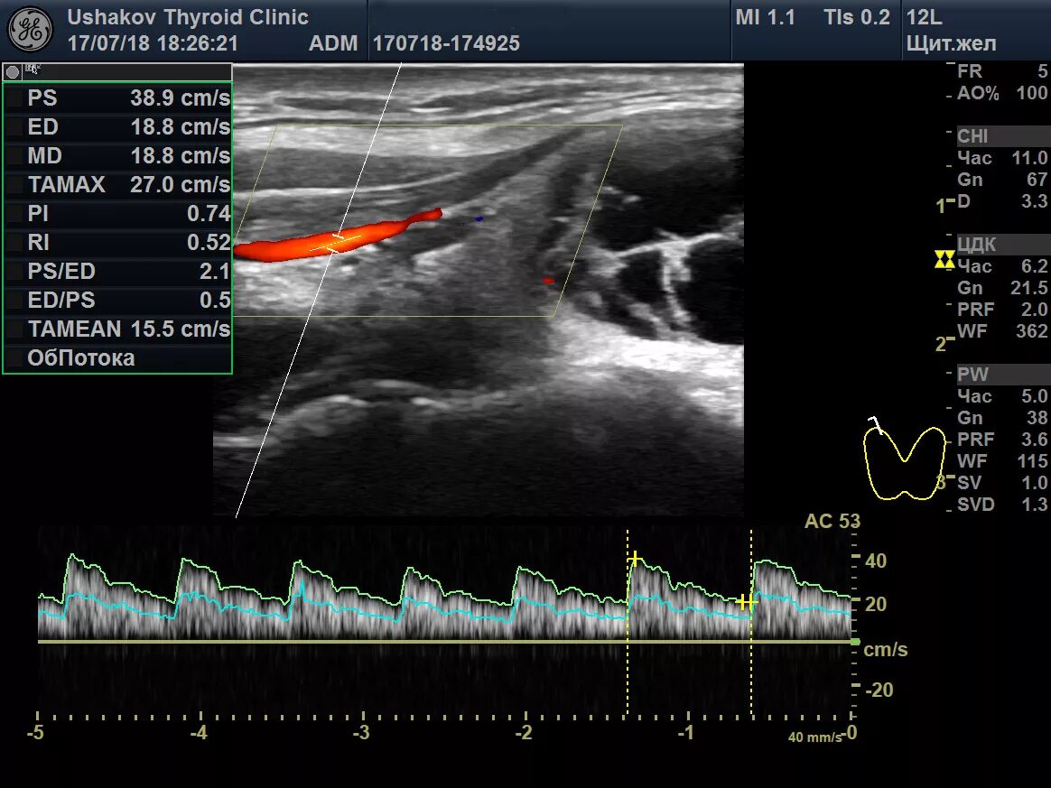 Патология почек узи изранов. Узи сердца видеоурок изранов. Узи предстательной железы изранов. Узи предстательной железы изранов. Узи изранов гинекология.