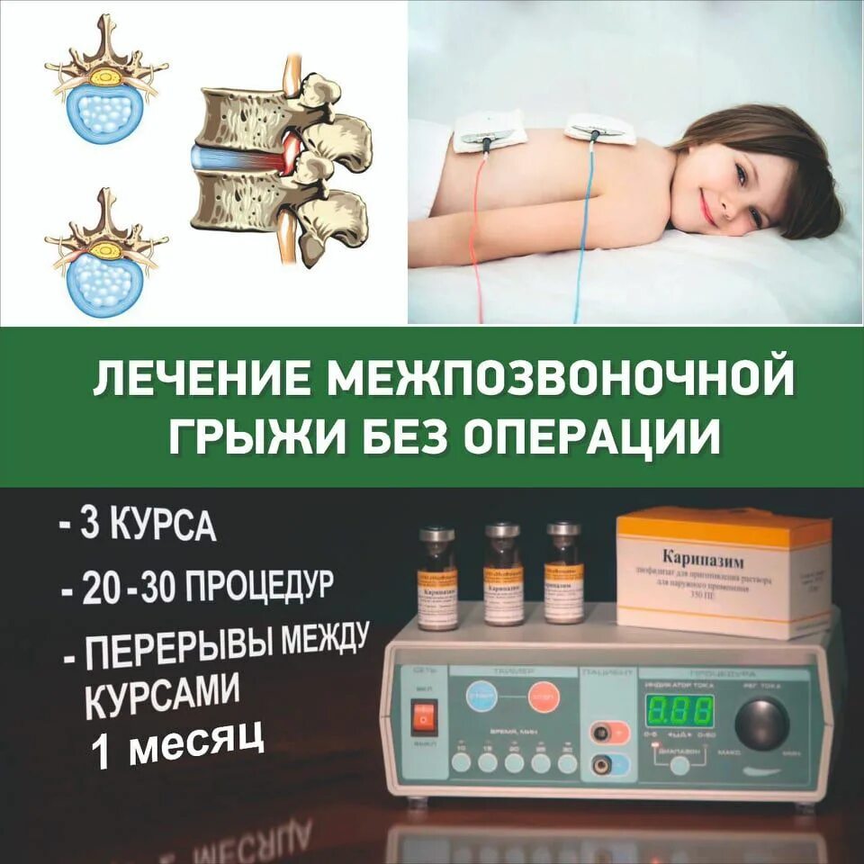Электрофорез межпозвоночная грыжа лекарства. Электрофорез при грыже позвоночника. Электрофорез межпозвоночной грыжи. Электрофорез межпозвоночной грыжи. Схема электрофореза с карипаином.