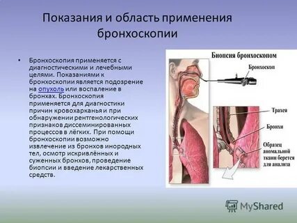 Бронхоскопия легких отзывы пациентов