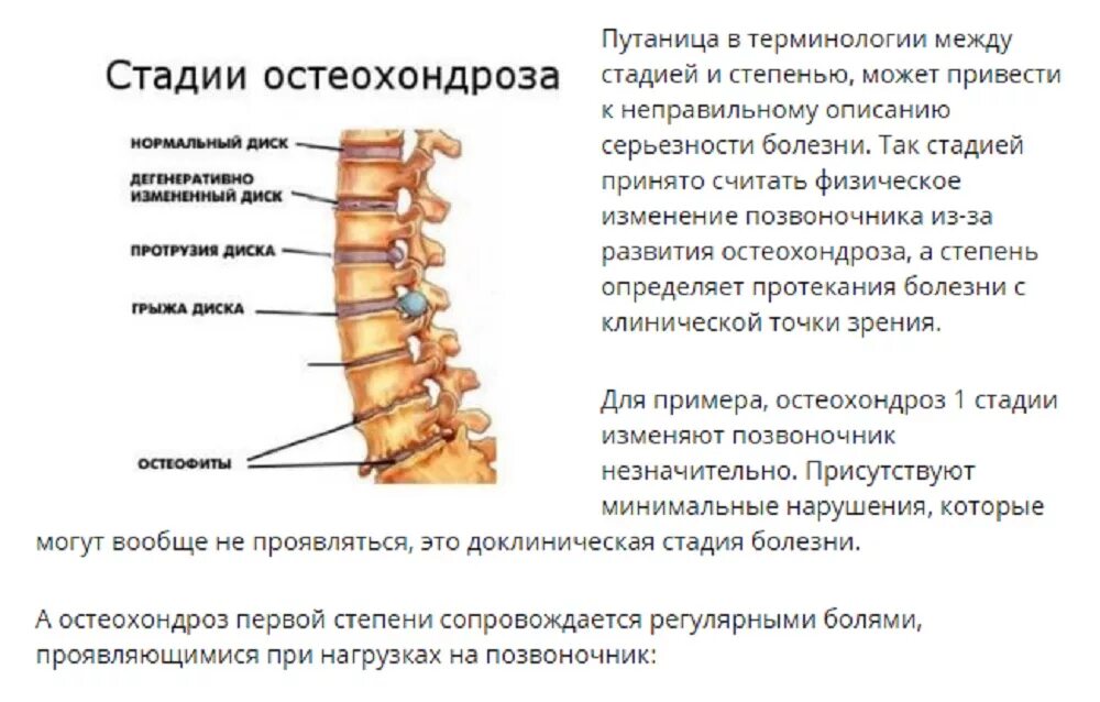 Остеохондроз шейного и грудного отдела позвоночника лечение. Межпозвонковый остеохондроз шейного отдела 1 -2 стадия. Остеохондроз 2 ст поясничного отдела позвоночника что это такое. Степени остеохондроза поясничного отдела позвоночника. Остеохондроз пояснично-крестцового отдела 2 степени.