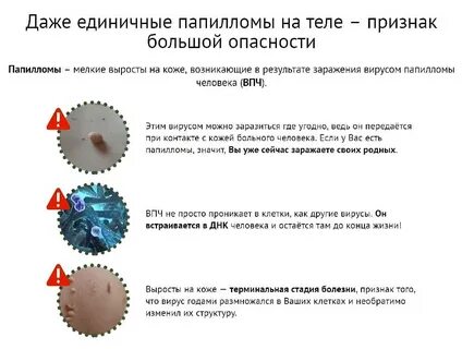 Впч у женщин что это такое