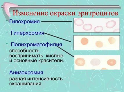 Гипохромия что это
