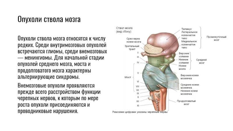 Диффузная глиома моста головного мозга. Опухоли моста и продолговатого мозга. Мозговой ствол. Глиома головного ствола