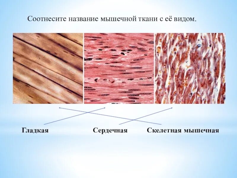 Мышечная ткань обладает способностью. Мышечная ткань название ткани. мышечная ткань текстура. мышечная ткань презентация. клетки мышц называются.