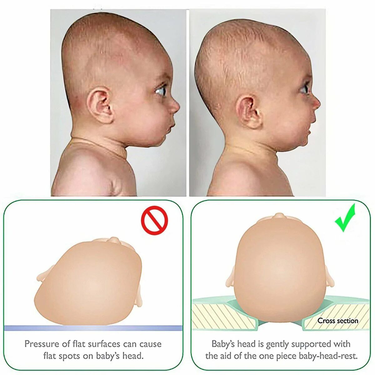 Форма головы новорожденного. Правильная форма головы у грудничка.