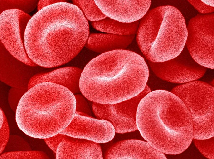 Эритроциты что это. Эритроциты. Эритроциты в крови. Тутовые ягоды эритроциты. Красные кровяные тельца.