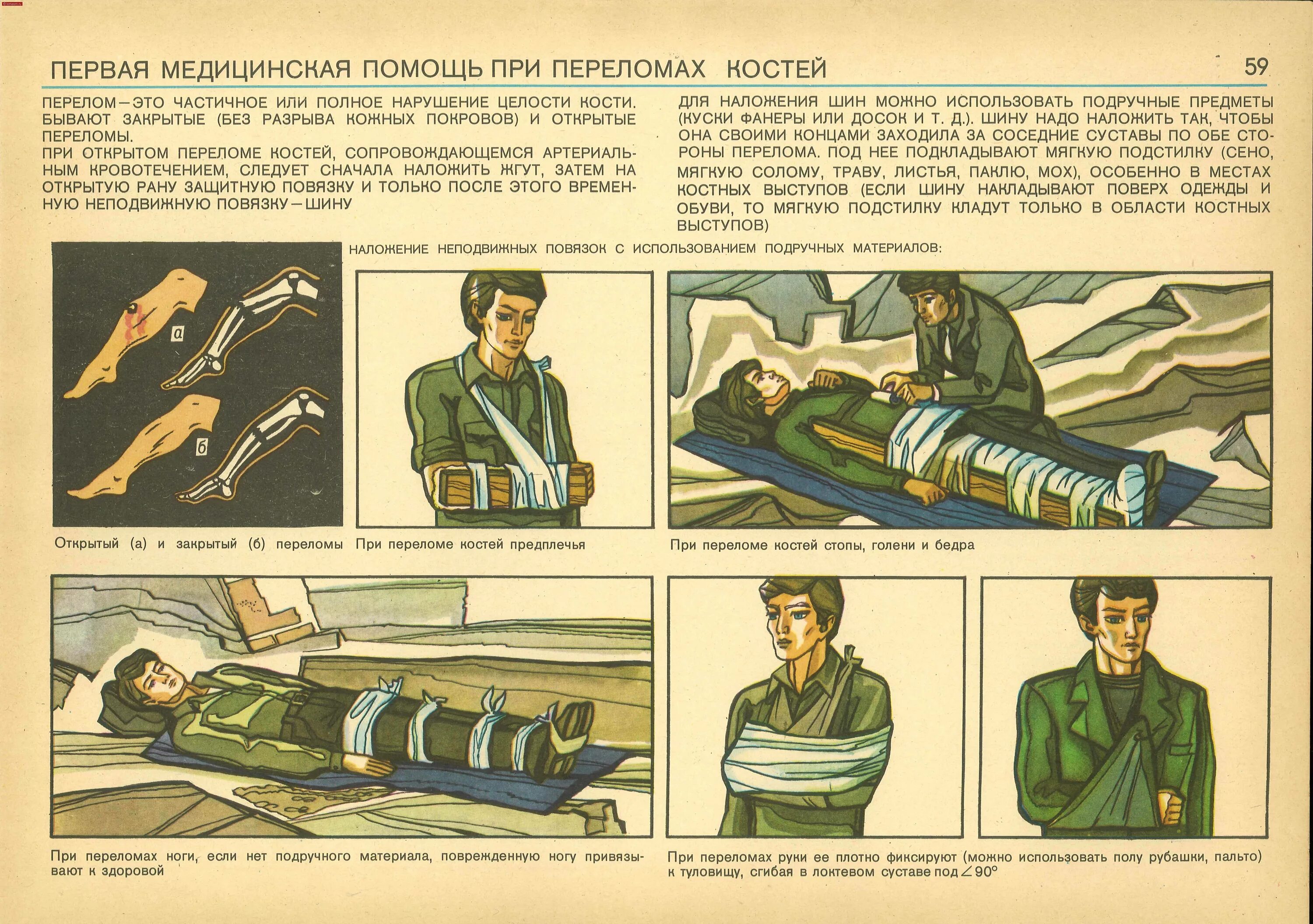 Плакаты медицинской помощи. Оказание первой помощи плакат СССР. Плакат первая медицинская помощь. Плакаты по первый попощ. Военно медицинские плакаты.