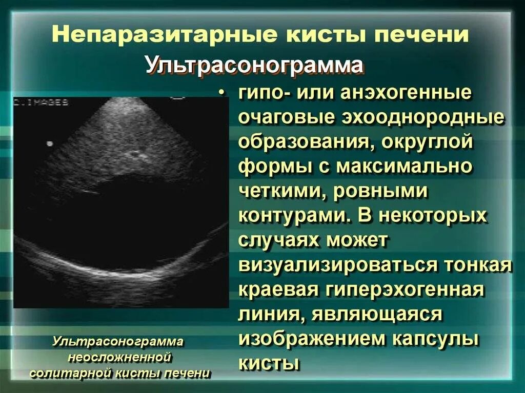 После удаления кисты печени. Кистозные образования печени. Анэхогенные образования в печени что это такое. Кистозное поражение печени.