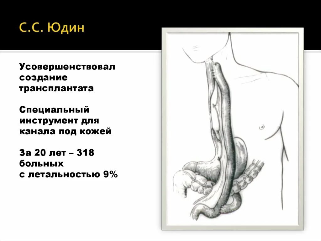Стеноз пищевода симптомы. Рубцовые сужения пищевода клинические рекомендации. ожоги и рубцовые сужения пищевода у детей клинические рекомендации. рубцовое сужение пищевода локализация. ожоги и рубцовые сужения пищевода презентация.