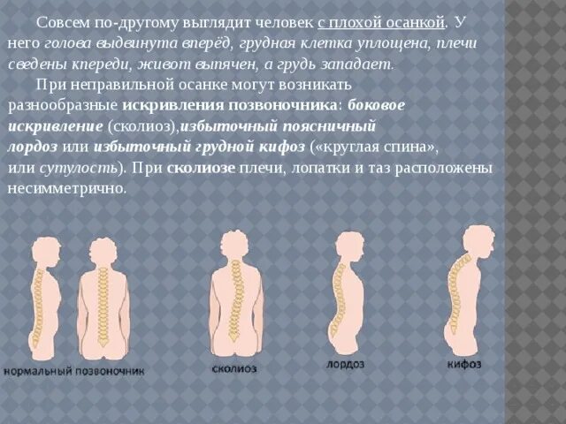 Плохая осанка портящая красоту жениха сканворд. Живот при неправильной осанке. Как выглядит человек с неправильной осанкой. Голова выдвинута вперед грудная клетка уплощена. Плохая осанка живот.