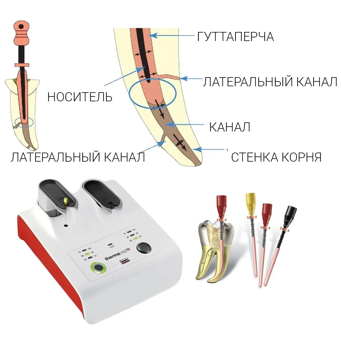 Гуттаперч вый опрометч вость. Пломбировочная система корневых каналов «Термафил».. ПРОТЕЙПЕР гуттаперчи f4. Аппарат для обтурации корневых каналов зуба. Система Термофил гуттаперча.