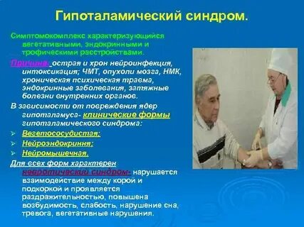 Синдром гипоталамуса