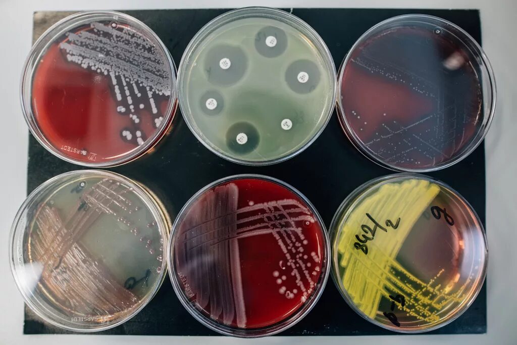 Чашки Петри микробиологическая лаборатория. Чашка Петри микробиология. Культуральный метод микробиология. Чашка микробиологическая (Петри).