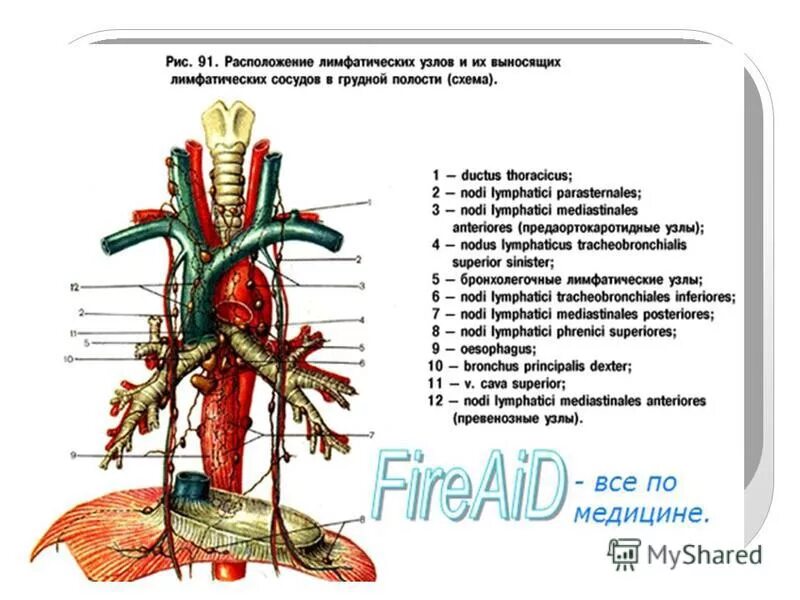 лимфоузлы сердца. лимфоузлы сердца. лимфатическая система таблица 8 класс. лимфа сосуды расположение в организме. задние средостенные лимфатические узлы.