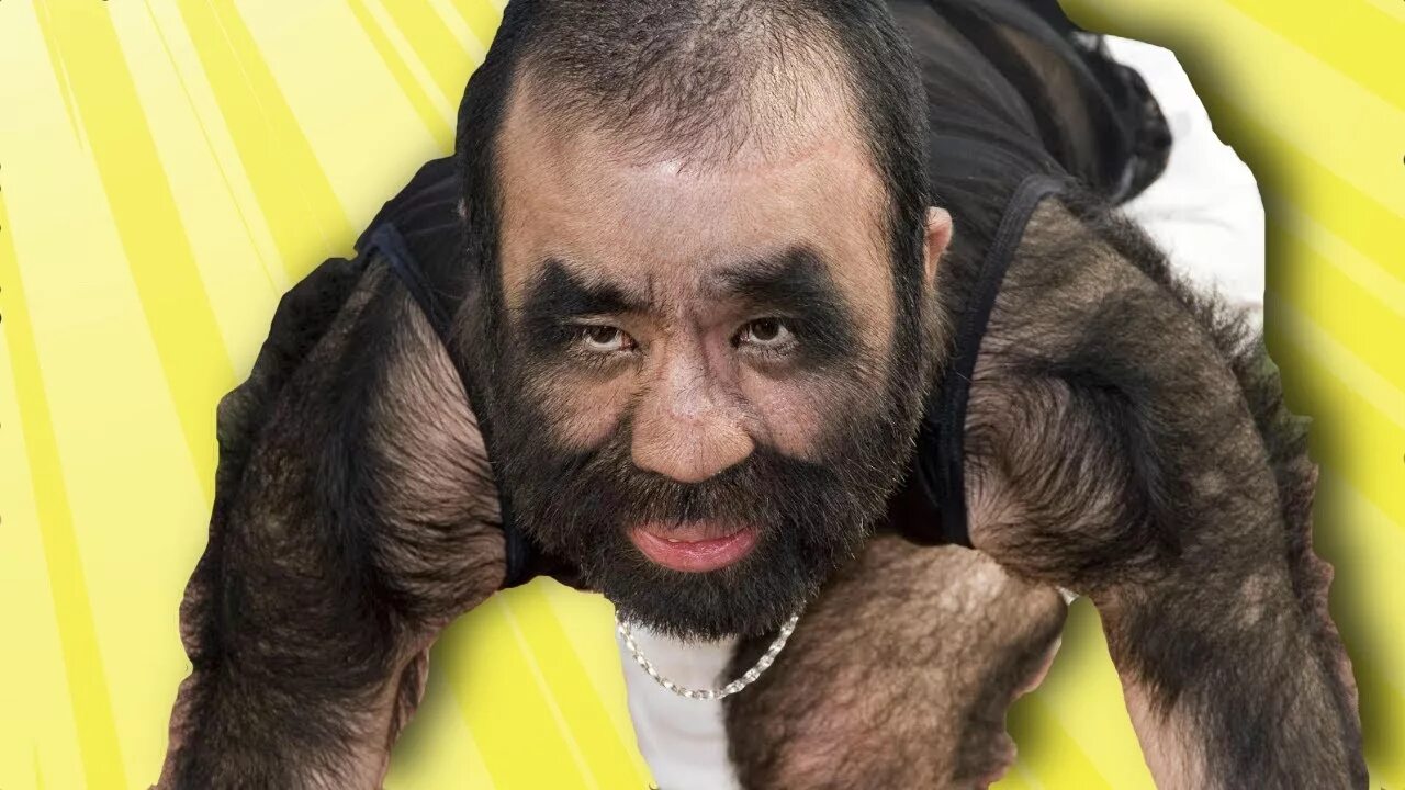 Hairy ugly. Полностью волосатый человек.