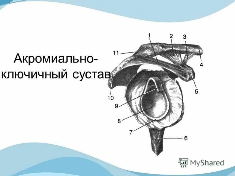 Степени повреждения акромиально-ключичного сочленения. Классификация переломов акромиального конца ключицы. Акромиально-ключичный сустав анатомия строение. Грудино акромиальный сустав анатомия. Подвывих акромиально-ключичного сустава.