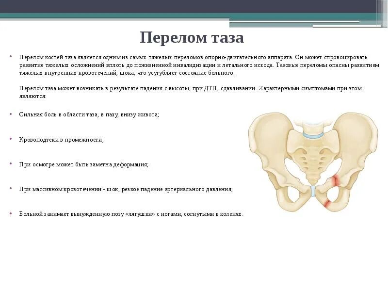 Наиболее опасный перелом костей таза тест. Расхождение лонного сочленения степени УЗИ. Симптомы расхождения симфиза при беременности. Перелом симфиза лонного сочленения. Расширение таза при беременности