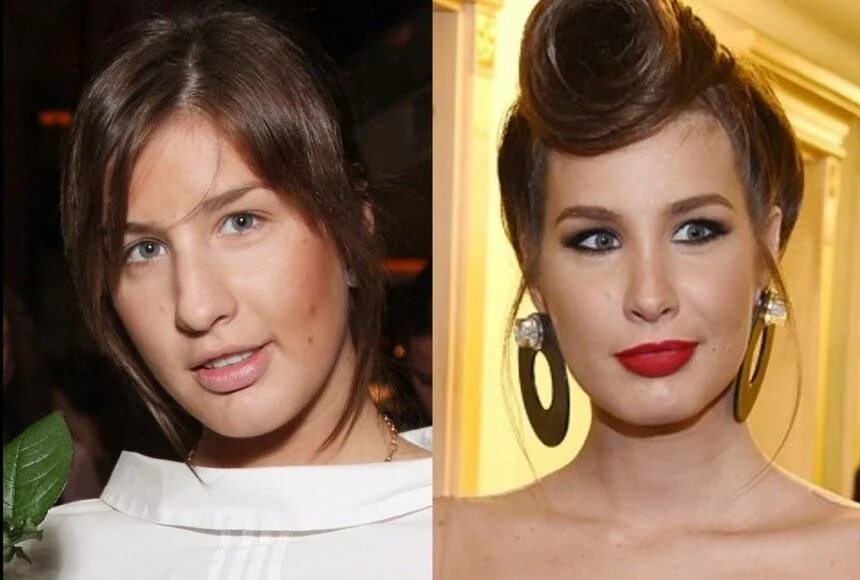 Топурия кэти с носом. Топурия до и после пластики. Топурия до и после пластики. Катя попурия до пластики. Этитопурия до пластики.