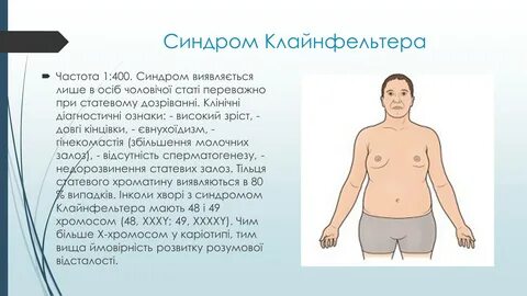 Больные синдромом клайнфельтера
