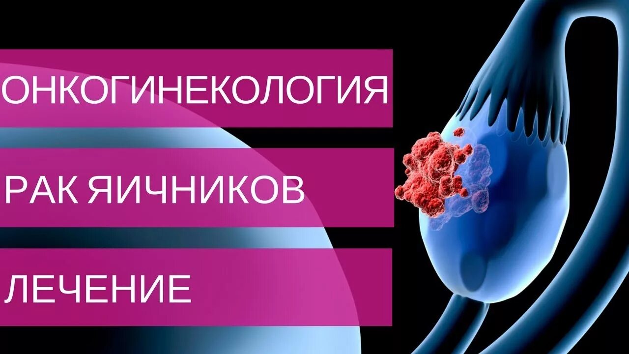 рак яичников лечение. принципы лечения доброкачественных опухолей яичника. операция по онкологии яичников. лекарство при онкологии яичника.