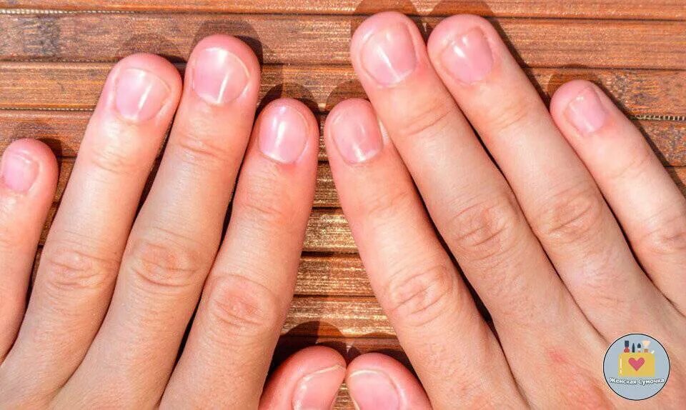 Почему ногти растут медленно. Здоровый цвет ногтей на руках. Ногти здорового человека.