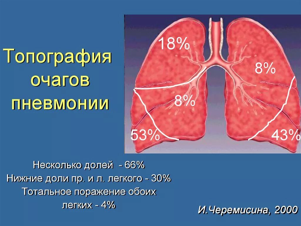 Очаговая пневмония очаг поражения. Топография очагов пневмонии. Пневмония поражение легких. Поражением легких 50