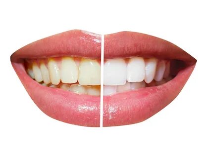 Teeth PNG Images Transparent Free Download.