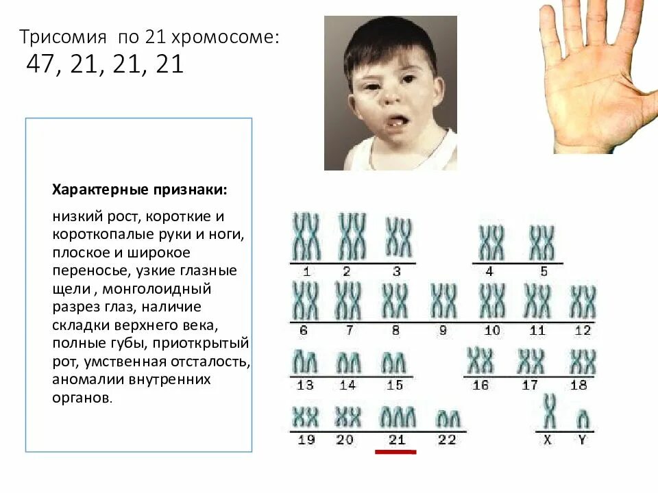 Скольк офромосом у человека. Сколько хромосом у селовек. Наличие лишней хромосомы