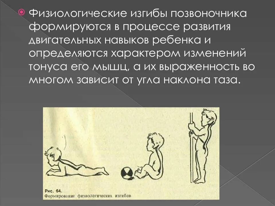 Формирование физиологических изгибов. Физиологические изгибы позвоночника. физиологические изгибы позвоночника формируются. формирование физиологических изгибов позвоночного столба. физиологические изгибы позвоночника возраст.
