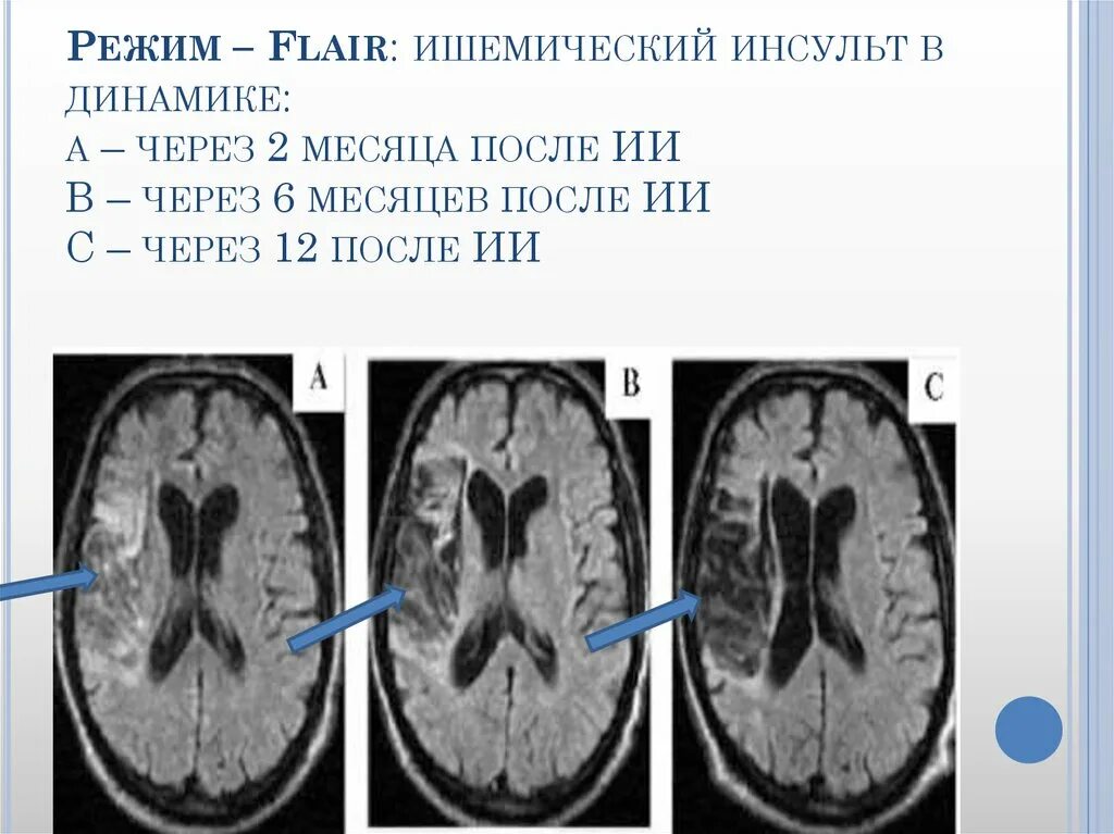Диафильм двенадцать месяцев. Этапы развития рисунка доизобразительный этап мотивы. Мотивы доизобразительного этапа. Через 6 12 месяцев после. Через 6 12 месяцев после.