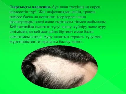 Жыртылған аналь туралы порно фильмдер