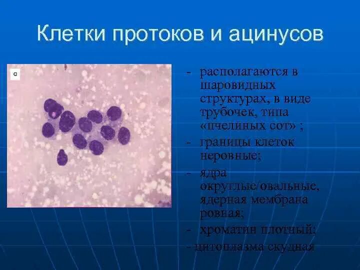 Цитологическое исследование пунктата. Клетки молочной железы цитология. Цитология молочный железы. Цитология отделяемого молочной железы. Цитологическое исследование пунктатов молочной железы.