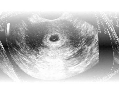 Беременность 2 нед. Эмбрион на 2 недели беременности от зачатия. Эмбрион на 2 недели беременности УЗИ. Эмбрион 2 недели от зачатия УЗИ. УЗИ 2 недели беременности от зачатия.