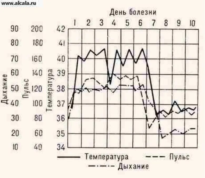 Температурный лист графическим. Температурная кривая при крупозной пневмонии. Температурный лист пневмония. Температурный лист при крупозной пневмонии. Температурный лист больного пневмонией.