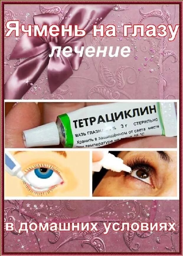 Печмерь на глазу лечение.