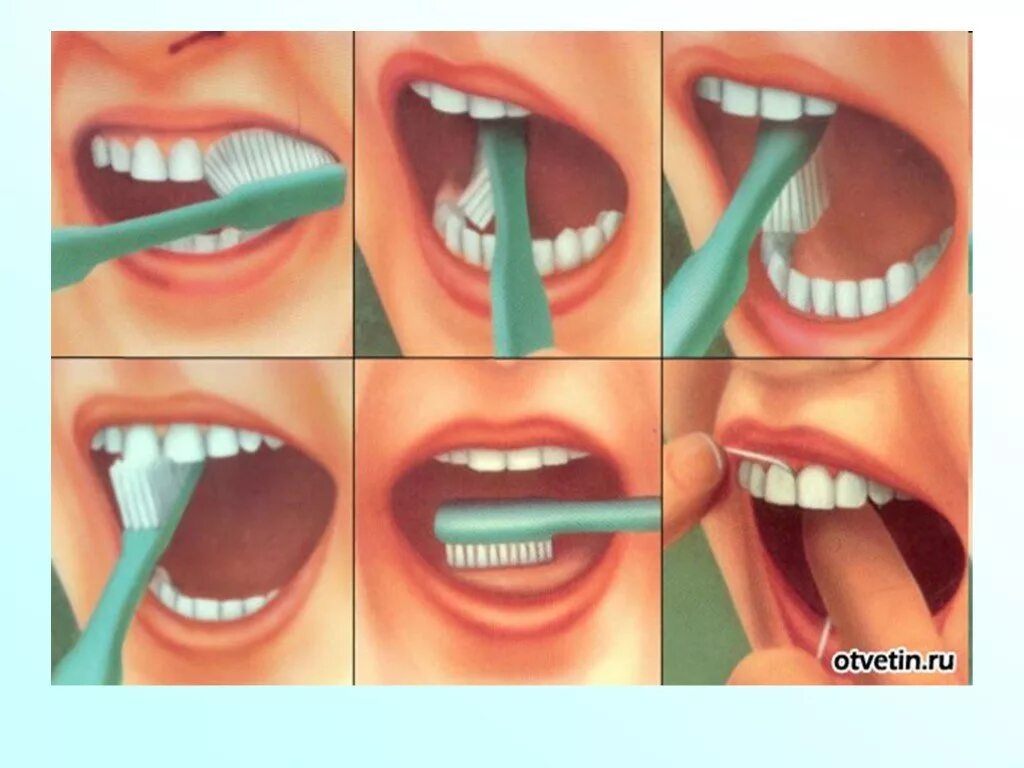 Плохая гигиена рта. Гигиена зубов. Как чистить зубы. Гигиена ротовой полости.