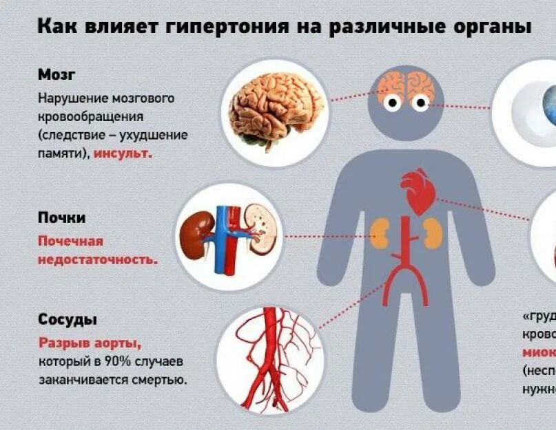 Гипертония. Гипертоническая болезнь симптомы. Профилактика гипертонической болезни. Гипертония симптомы.