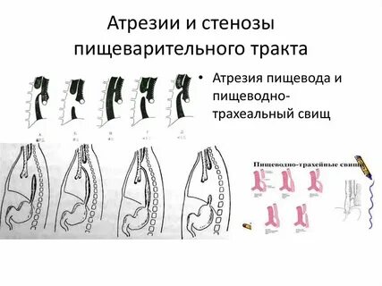 Девственная плева