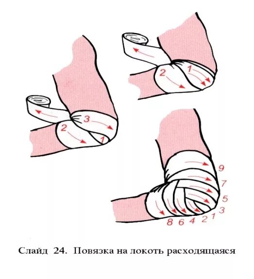 Как наложить бинт. Бинтование голеностопного сустава. перевязка локтя эластичным бинтом. локтевой сустав бинтовать. бинтование ран.