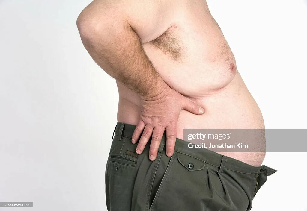Живот у мужчин. Лишний вес у мужчин. Абдоминальное ожирение у женщин фото.