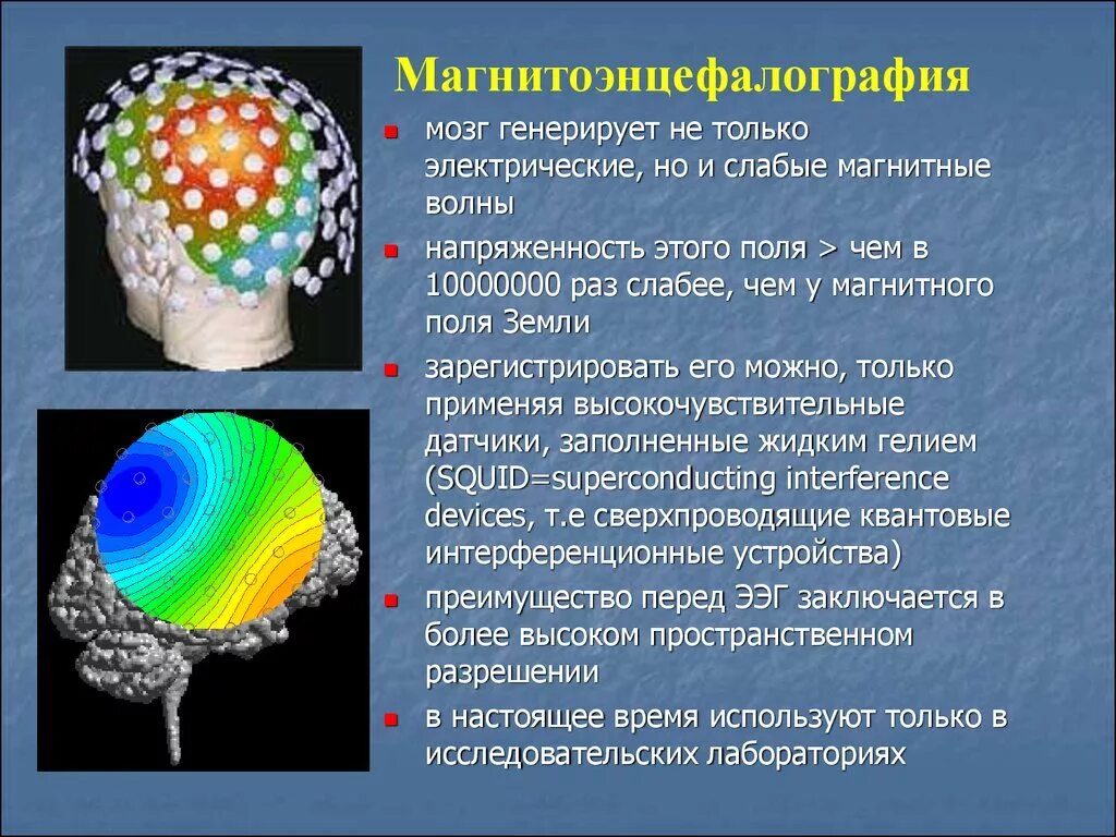 Мозг магнитное поле. Магнитоэнцефалография. Магнитоэнцефалография мозга. Магнитоэнцефалография сущность метода. Электромагнитное поле мозга.