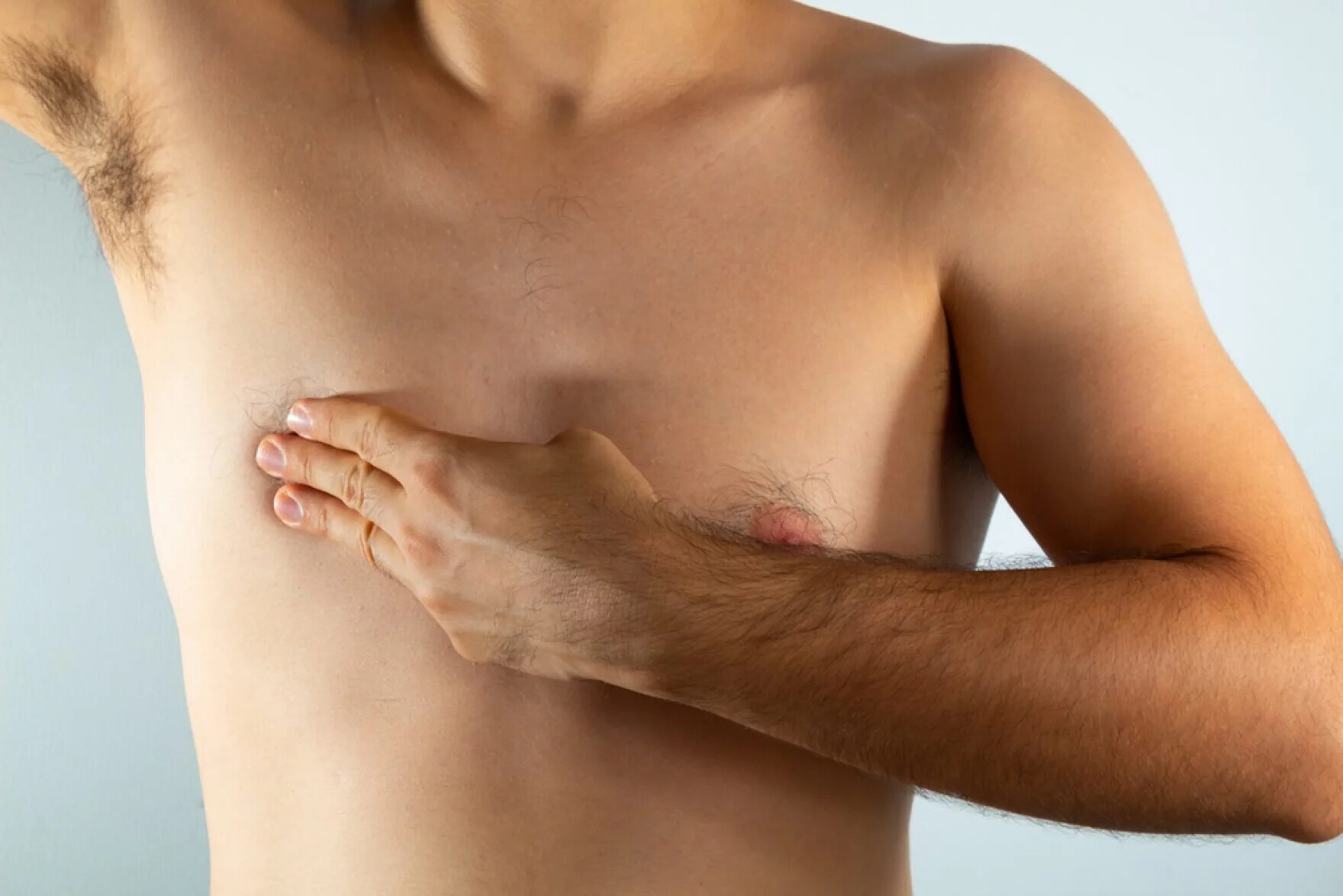 Male breast. Мужская грудь. Мужская грудь с молочными железами. Male breast. Мужская грудь.