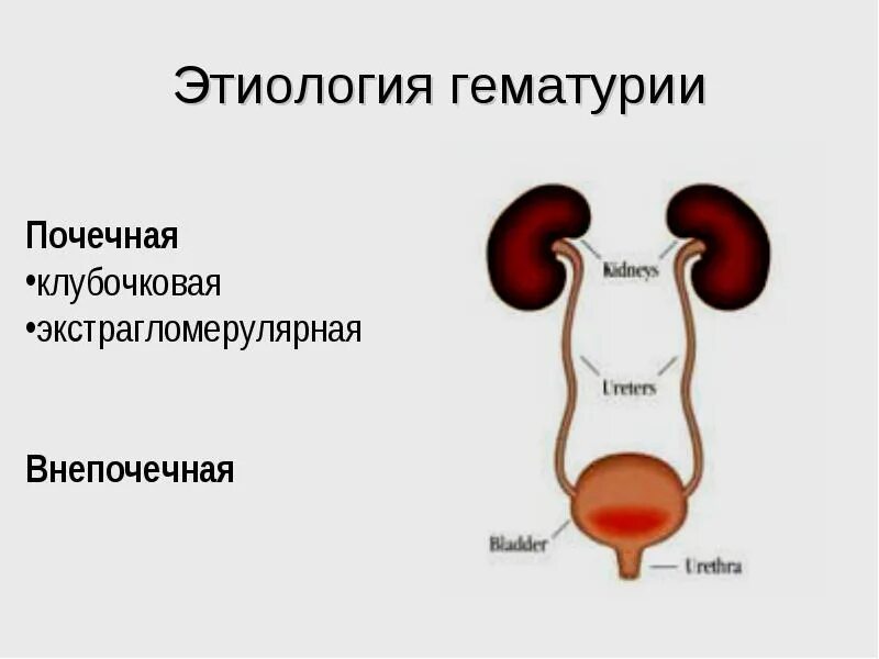 Гематурия этиология. Гематурия этиология патогенез. Почечная гематурия. Тотальная гематурия.