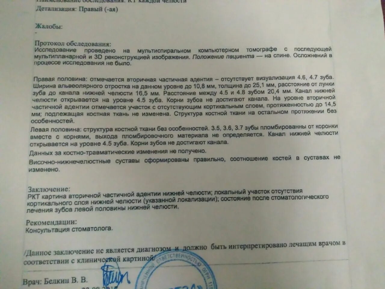 Мрт без направления врача можно ли сделать. Заключение узи височно-нижнечелюстного сустава. узи височно-нижнечелюстного сустава протокол. узи нижнечелюстного сустава протокол. мрт височно-нижнечелюстного сустава описание.